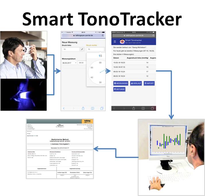 SmartTonoTracker